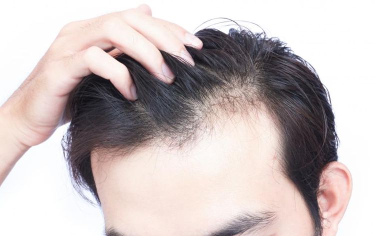Best Hair Fall Treatment in Hindi